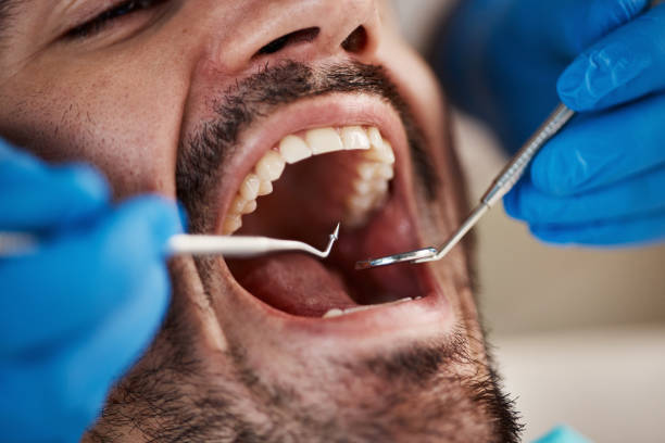 Best Emergency Dental Care for Broken or Chipped Teeth in Medina, OH