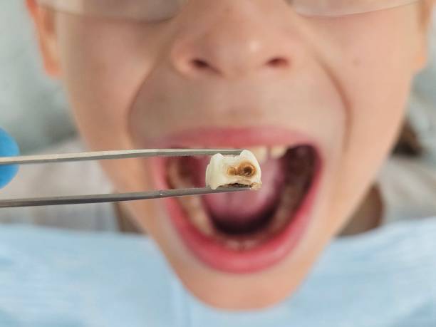 Best Pediatric Emergency Dentist in Medina, OH